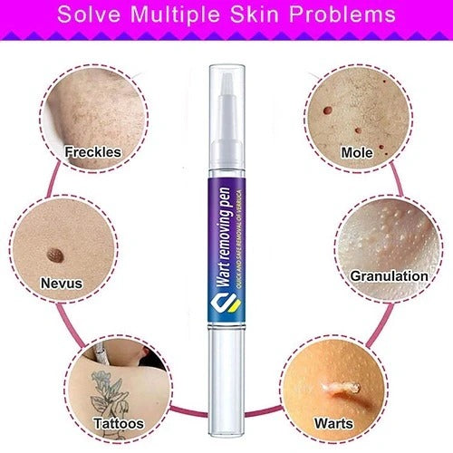 Warts & Moles Remover Pen (14 Days Money Back Guarantee)
