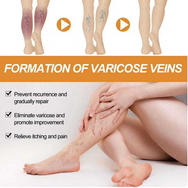 Turmeric Varicose Veins Relief Spray
