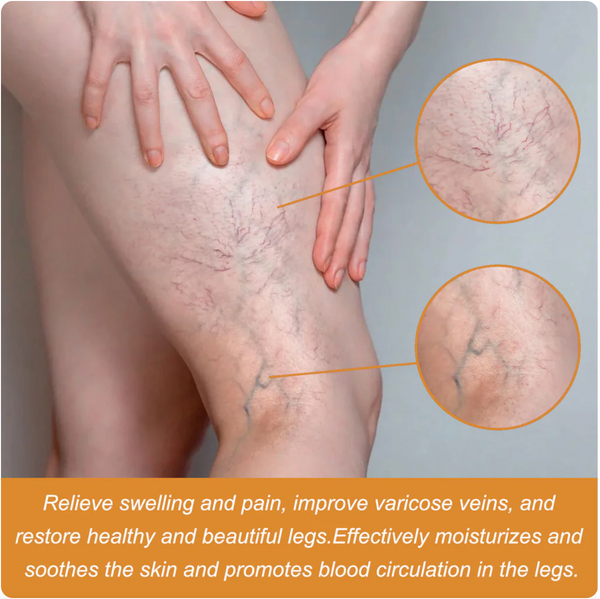 Turmeric Varicose Veins Relief Spray