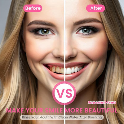 Niacinamide Whitening Toothpaste - For Healthier, Whiter Teeth!✨