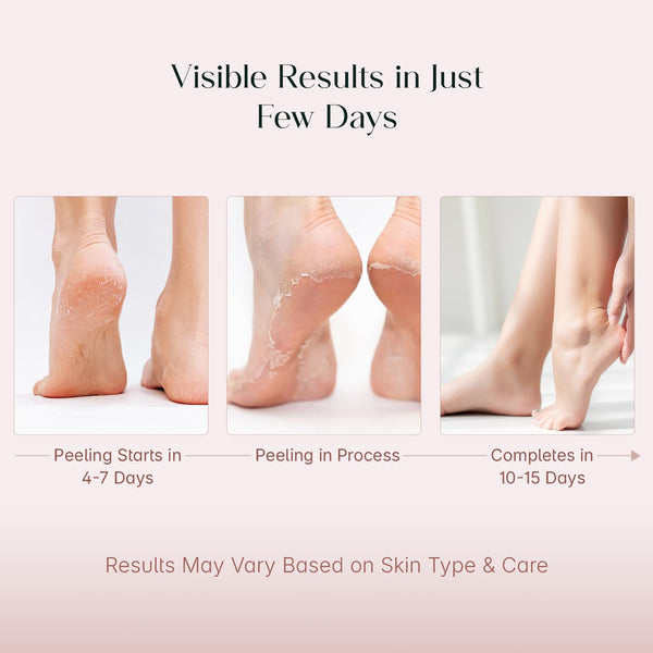 Korean Foot Peeling Mask (1 Pair)