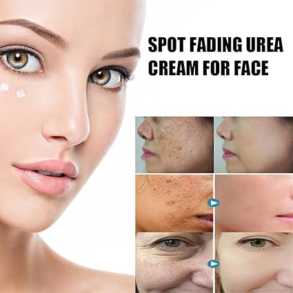 Spot Fading Urea Cream