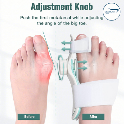 Pain Relief Bunion Toe Corrector - (IMPORTED)