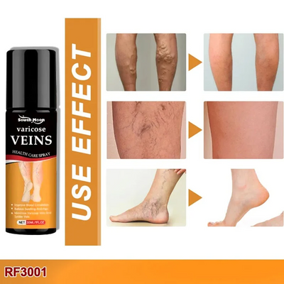 Turmeric Varicose Veins Relief Spray